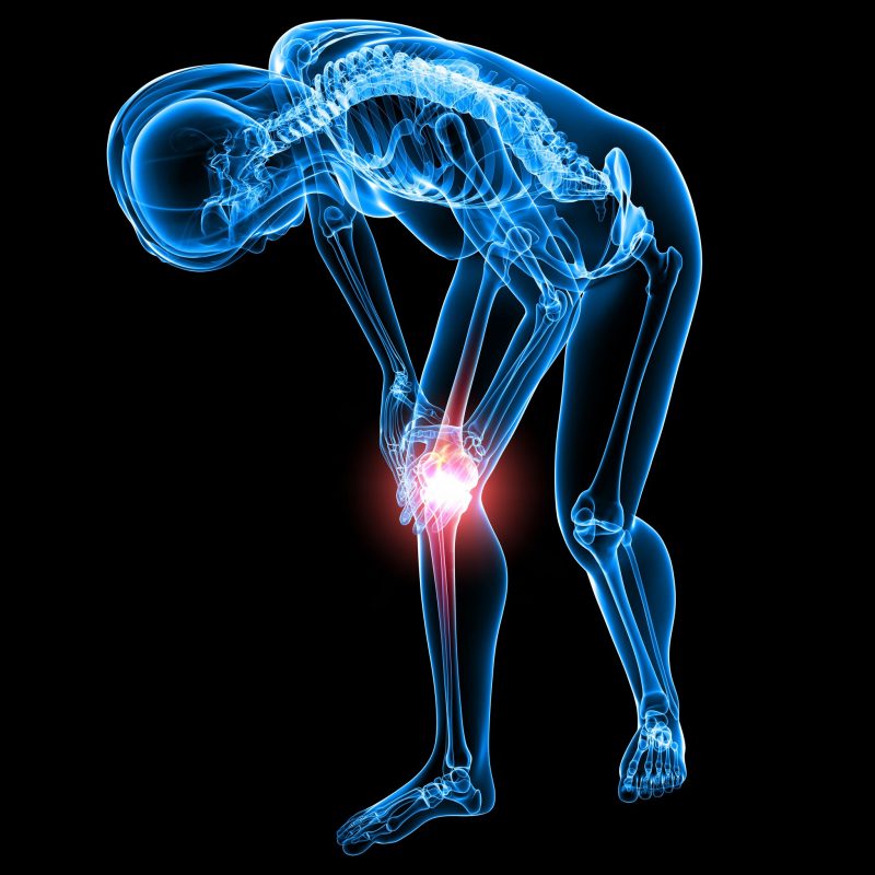 IBS: How to Find Relief with Acupuncture Treatments