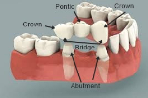 Why A Cosmetic Dentist In Castle Hill Is Convenient And Effective
