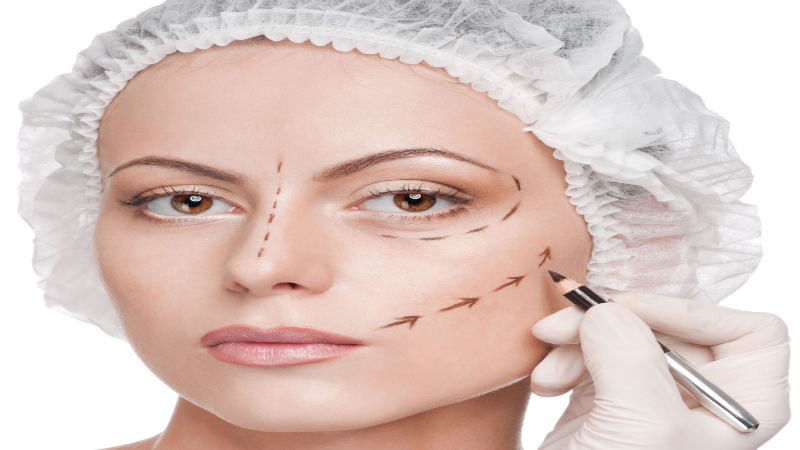 Blepharoplasty: Risks and Preparation