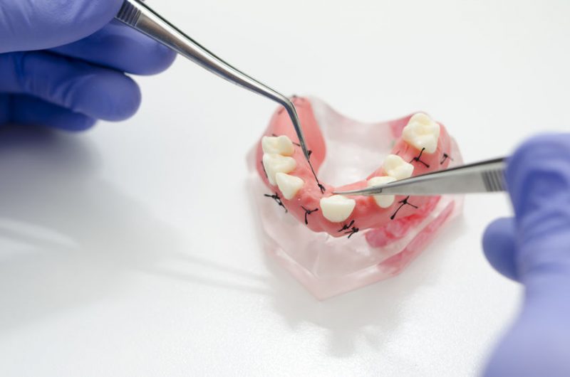 Your Lakeview Dentist Tips for Denture Care