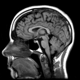 How Serious is That Head wound? What to Know About Traumatic Brain Injury