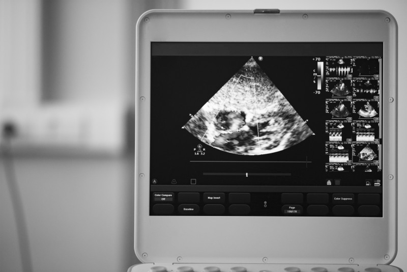 All You Need To Know About Ultrasound Machines And Where To Purchase One